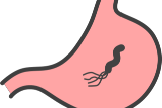 胃がんとピロリ菌の関係